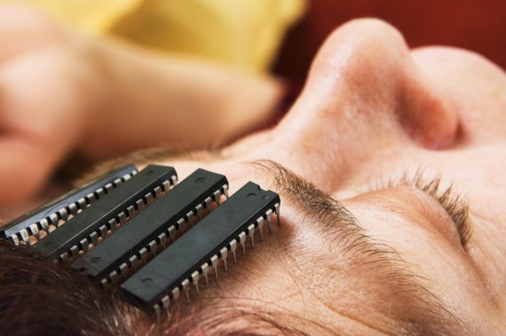 mb-160831-ThinkstockPhotos-99066093 Implantables, Medizin-Chance mit Nebenwirkungen