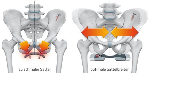 mb-richtige-Sattelbreite Warum schmerzt ein Sattel? Die Sitzknochen müssen genug Platz auf dem Sattel haben.