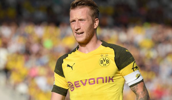 Borussia Dortmund ist eines von drei Bundesliga-Teams, das einen Ausrüstervertrag mit dem Herzogenauracher Sportartikelhersteller Puma hat. 